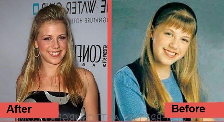 Jodie-Sweetin-boobs-job-before-and-after-plastic-surgery-2-1
