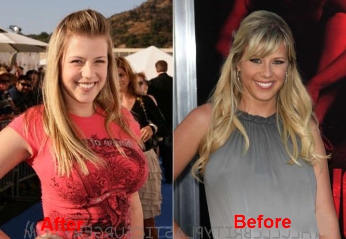 Jodie-Sweetin-boobs-job-results-before-and-after-plastic-surgery-1-1