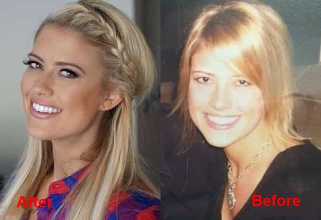 hristina-el-moussa-plastic-surgery-before-and-after-picture-1