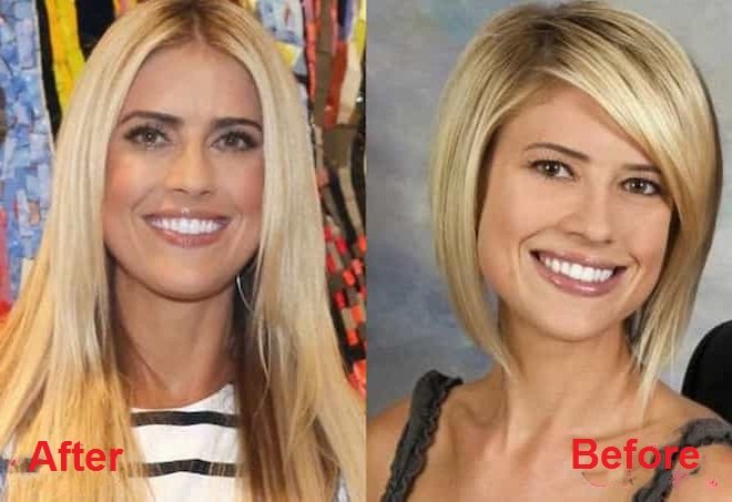 christina-el-moussa-plastic-surgery-before-and-after-picture