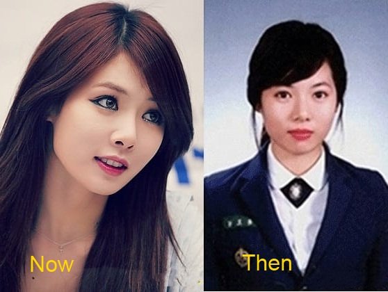 kim-hyuna-plastic-surgery-before-and-after-1-1