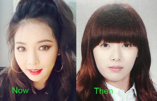 kim-hyuna-plastic-surgery-before-and-after-2-1