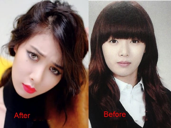 kim-hyuna-plastic-surgery-before-and-after-3-1
