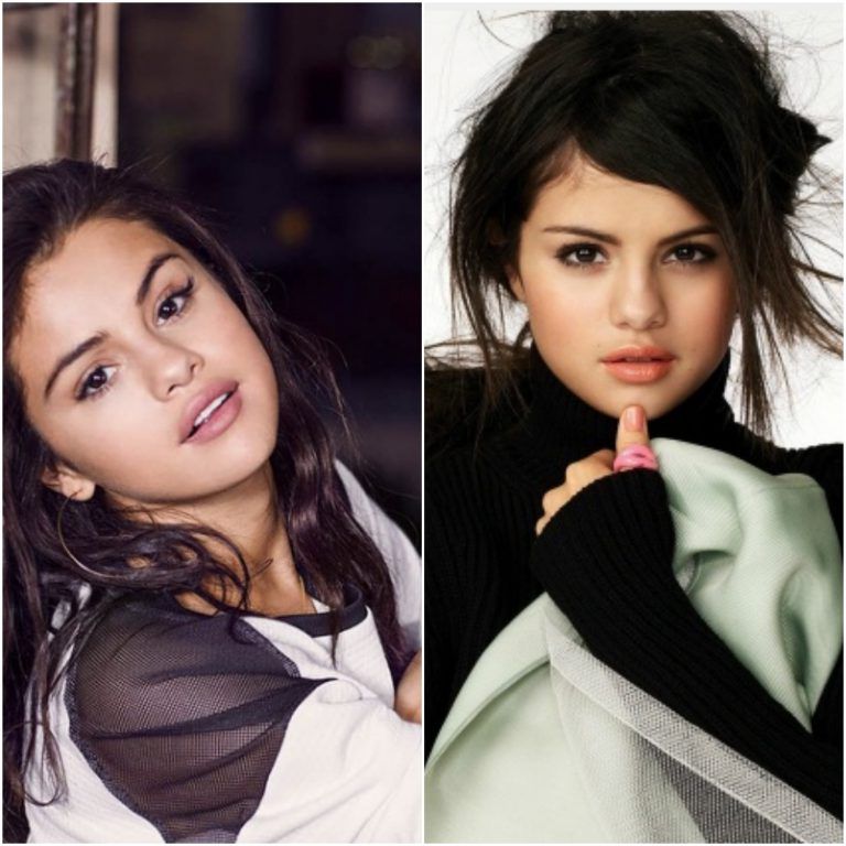 Did Selena Gomez get a Nose Job