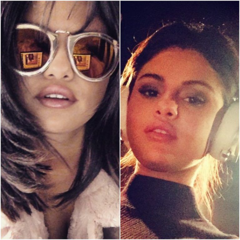  Selena Gomez Before and After Lip Injection Photos