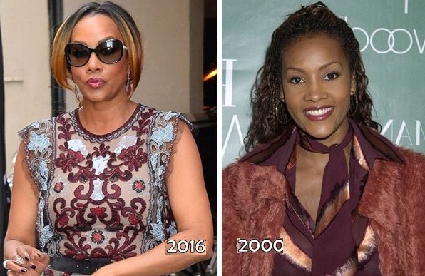 Vivica Fox before and after plastic surgery