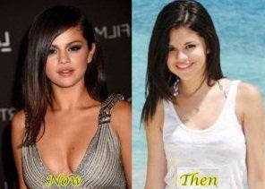 Selena Gomez before and after breast augmentation