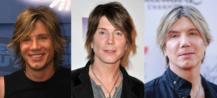 john rzeznik plastic surgery before and after 2021