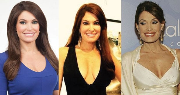 kimberly guilfoyle plastic surgery before as well as after pictures 2021
